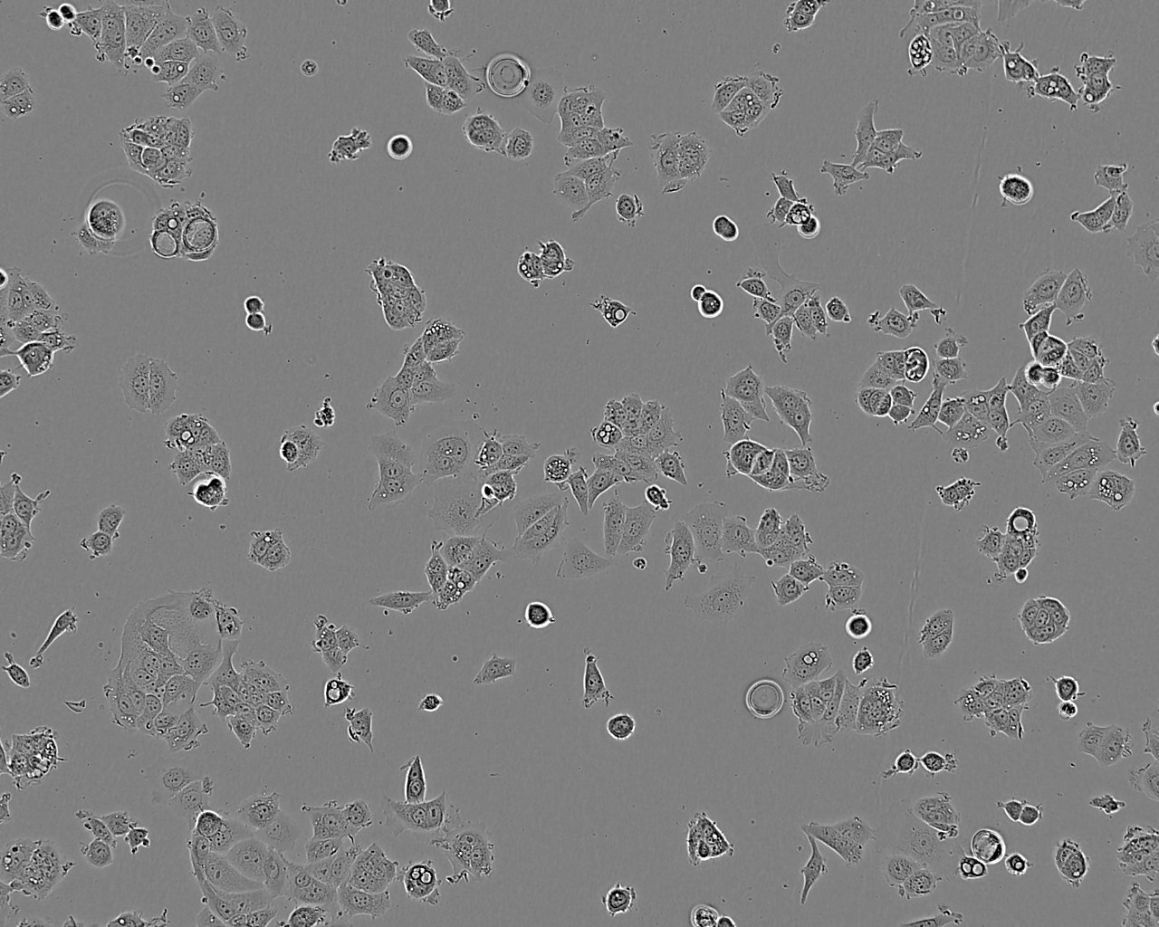 MS751细胞：人子宫颈表皮癌细胞系