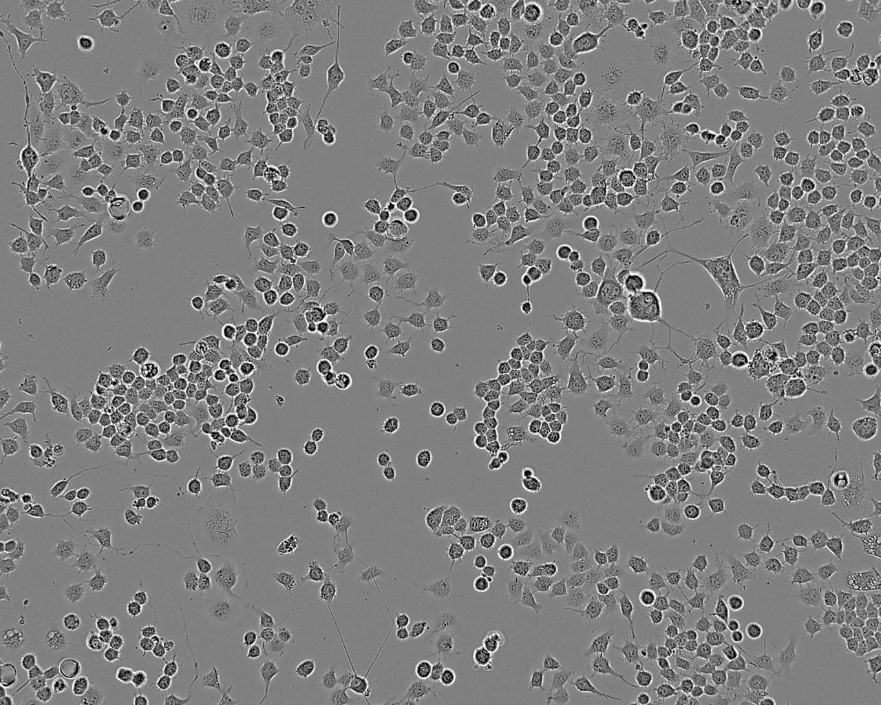 GI-1细胞：人神经胶质瘤和肉瘤细胞系