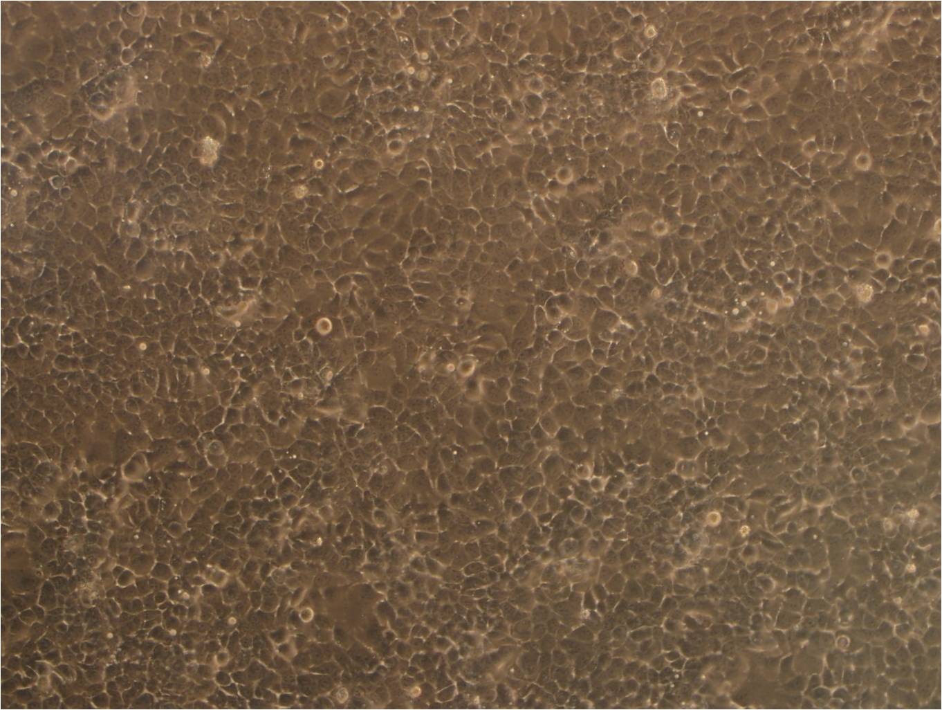 SW948细胞：人结肠腺癌细胞系