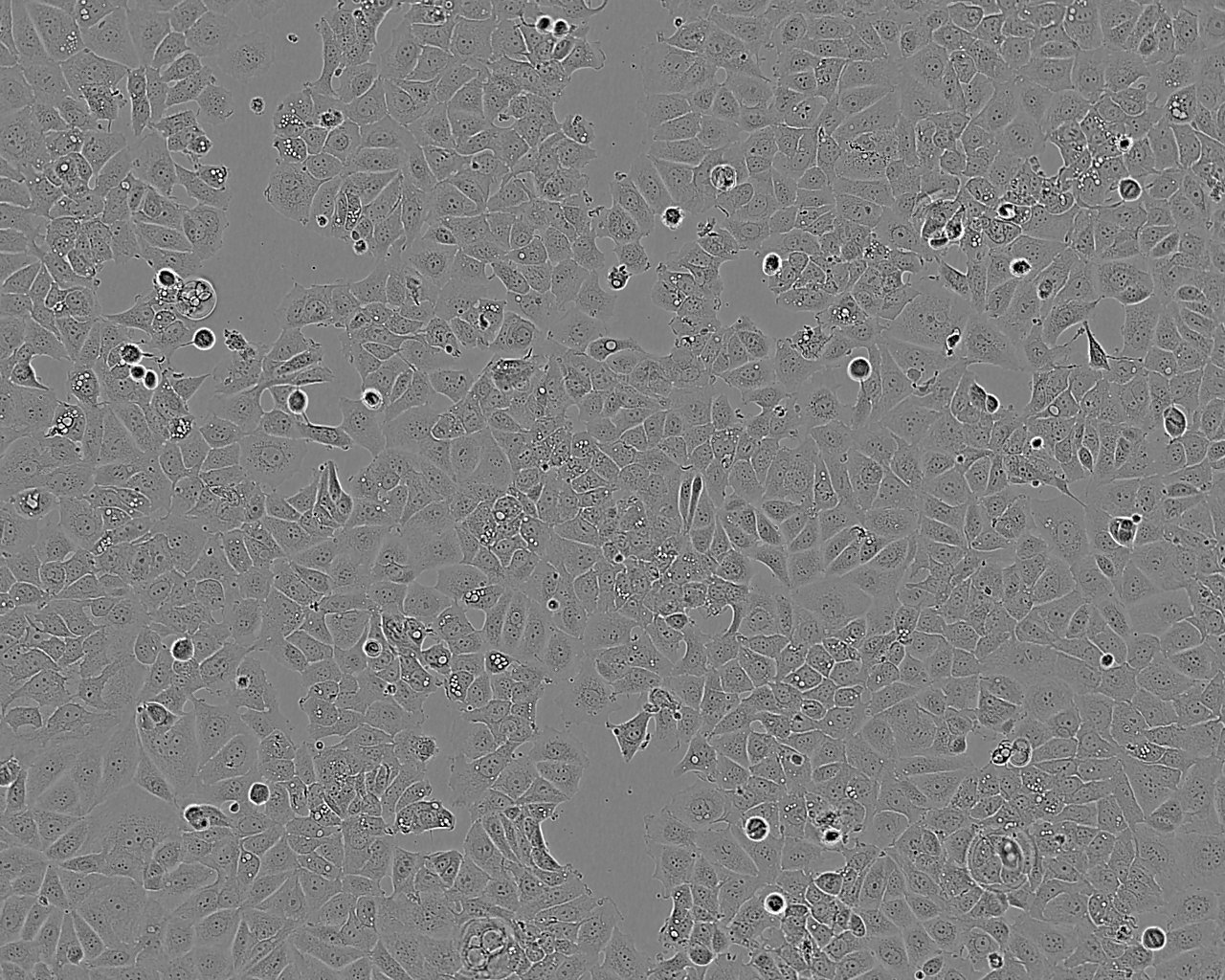 NCI-H2110细胞：人非小细胞肺癌细胞系