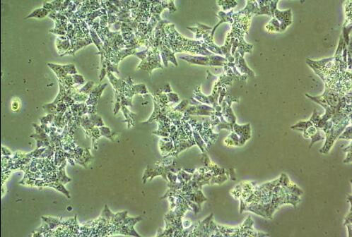 NCI-H1563细胞：人胚肺细胞系