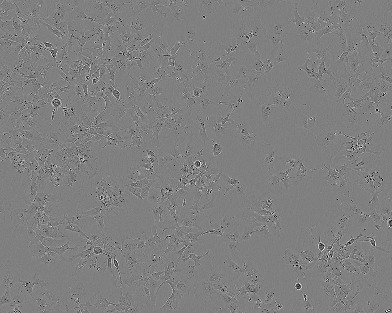 NCI-H1568细胞：人非小细胞肺癌细胞系