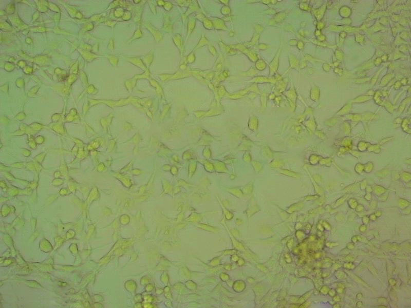 BpRc1细胞：小鼠肝癌细胞系