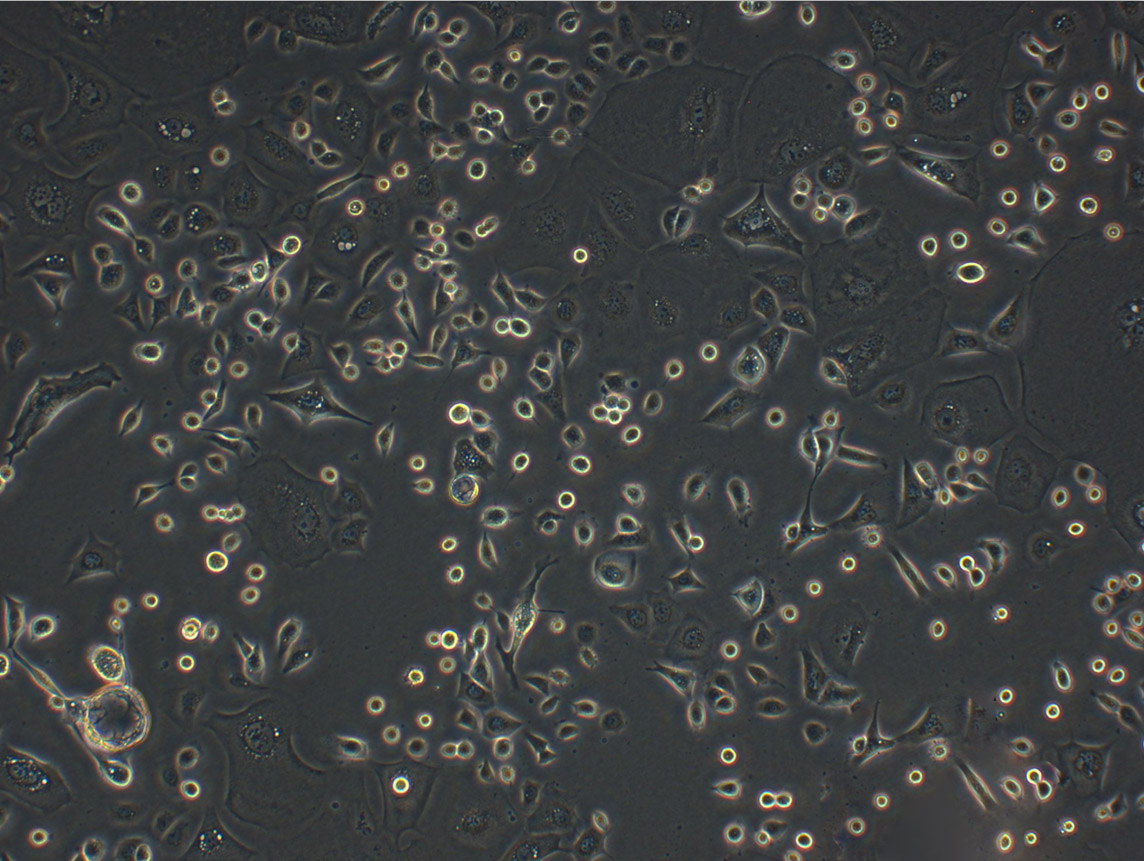 COLO 680N细胞：人食管鳞状癌细胞系