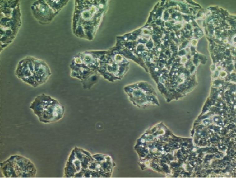 NCM460细胞：结直肠腺癌细胞系