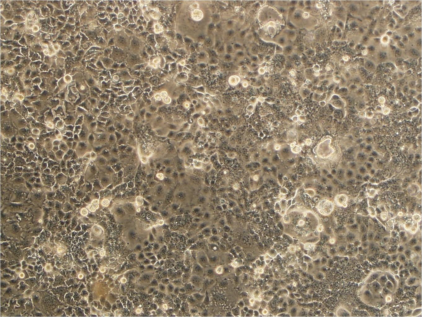 SNU-668细胞：人胃癌细胞系
