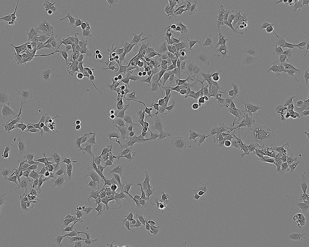 COR-L105细胞：人原发性非小细胞肺癌细胞系
