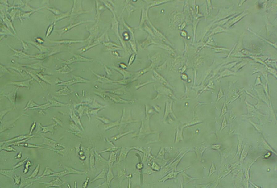 ECC10细胞：人子宫内膜癌细胞系