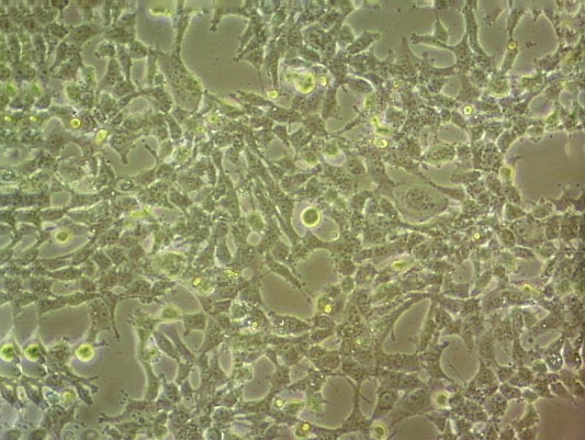 NCTC 1469细胞：小鼠正常肝细胞系