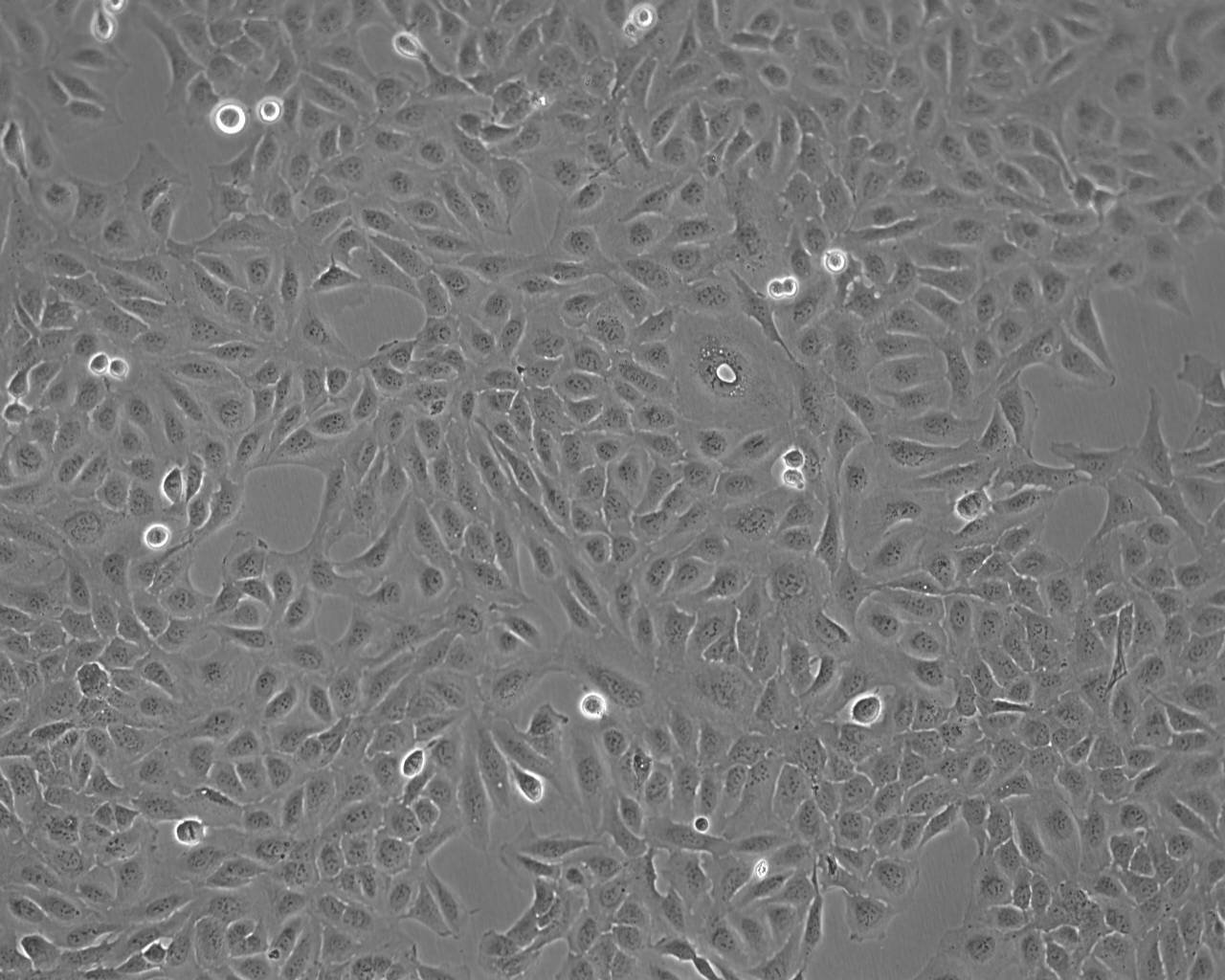 CCD-1095Sk细胞：人乳腺浸润性导管癌旁皮肤细胞系