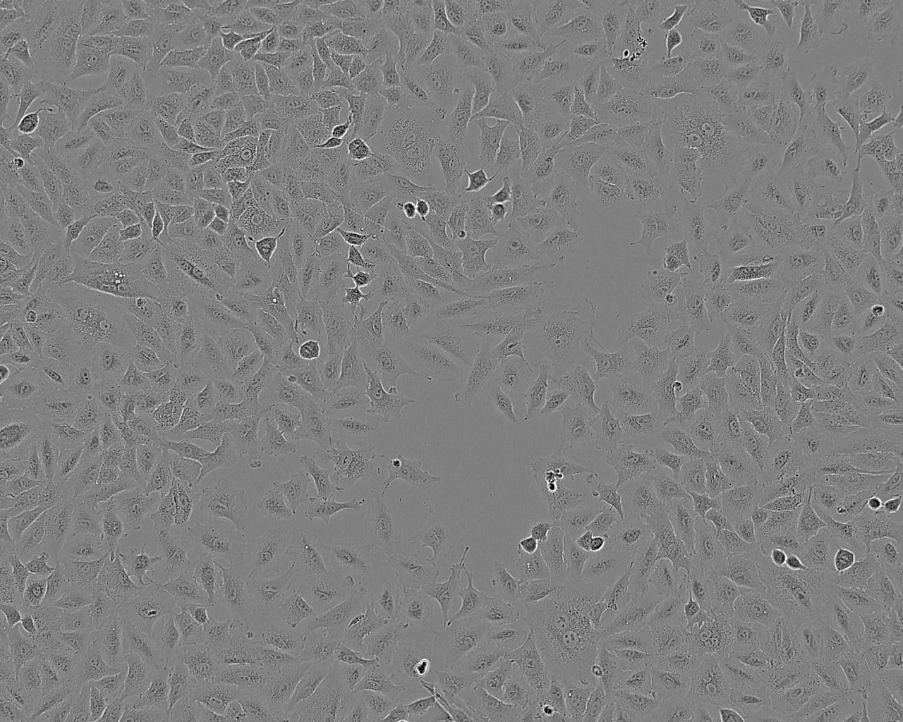 MEG-01细胞：人成巨核细胞白血病细胞系