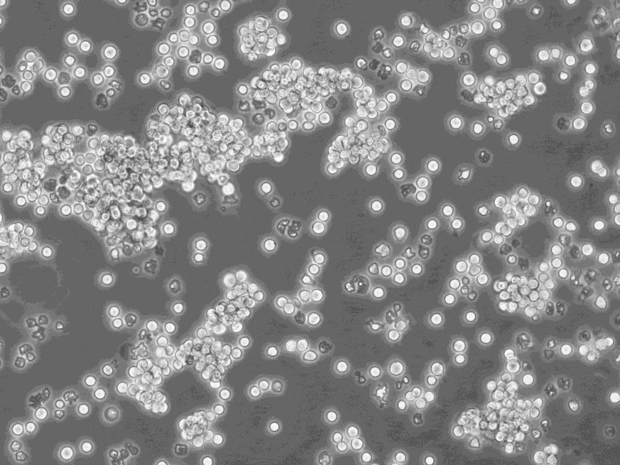 SUP-T1细胞：人淋巴母细胞淋巴瘤细胞系