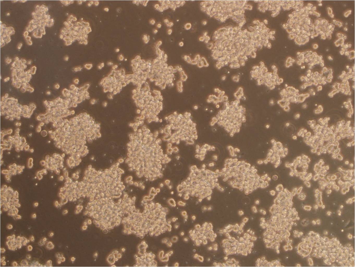 C8166细胞：人T淋巴细胞白血病细胞系
