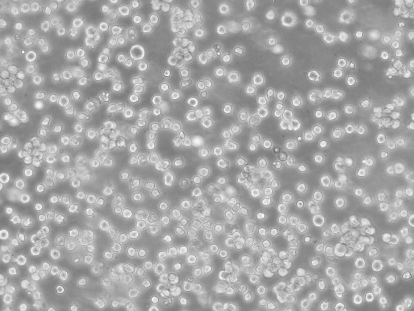 JOSK-M细胞：人急性单核细胞白血病细胞系