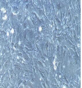 肾小球系膜细胞