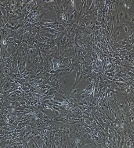 肾小球内皮细胞