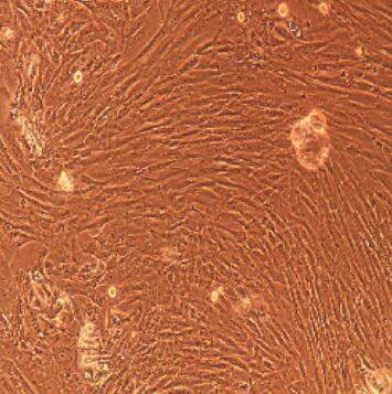 甲状腺成纤维细胞