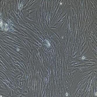 输卵管成纤维细胞