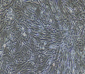 脂肪微血管内皮细胞
