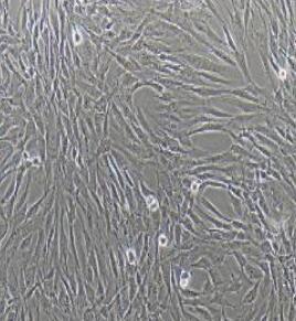 子宫成纤维细胞