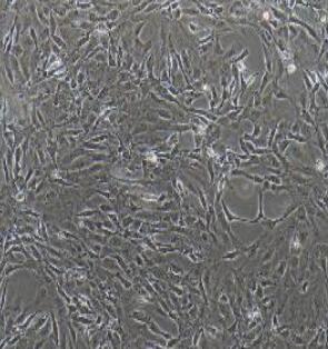 髓核细胞