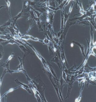 视网膜微血管内皮细胞