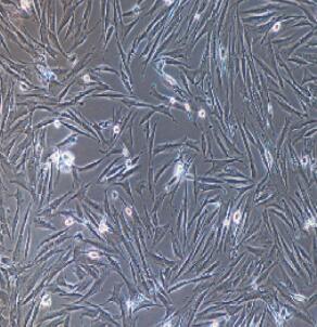人胎盘间充质干细胞