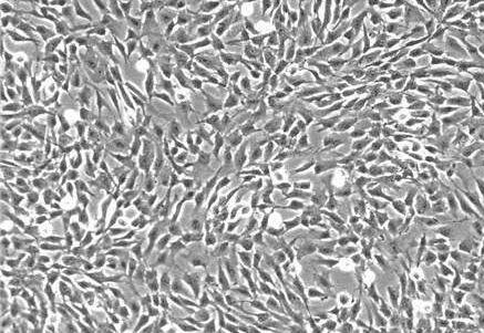 人胆囊成纤维细胞