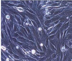 人胆囊平滑肌细胞