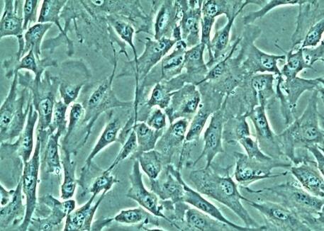 人胆囊微血管内皮细胞