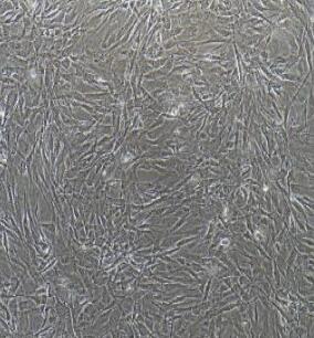 人肝成纤维细胞