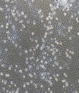 大鼠肺微血管内皮细胞