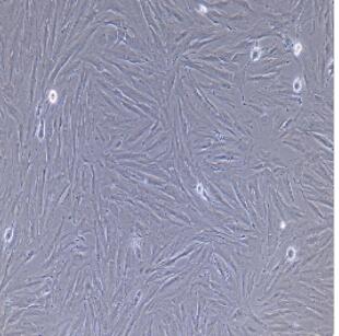 大鼠主动脉外膜成纤维细胞