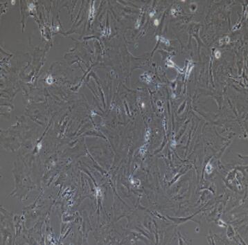 大鼠肾足细胞