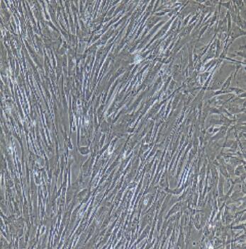 大鼠膀胱基质成纤维细胞