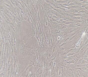 大鼠乳腺成纤维细胞