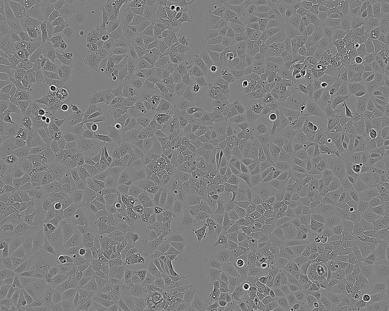 HCC78 Cells|人肺腺癌细胞系