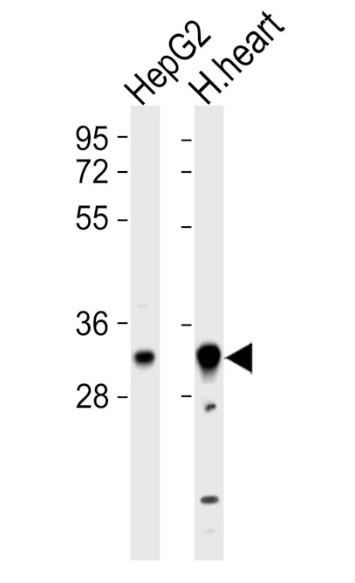 Anti-HCCS antibody produced in rabbit