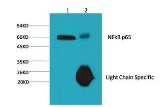 ANTI-NF-KB P65抗体