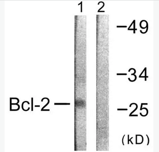 ANTI-BCL-2抗体