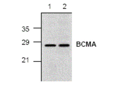 Anti-BCMA 抗体