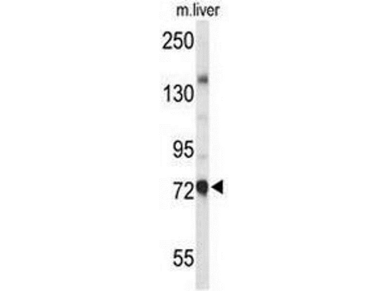 ANTI-CHOLINE ACETYLTRANSFERASE