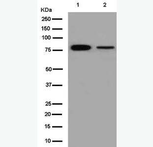 Anti-RANK antibody