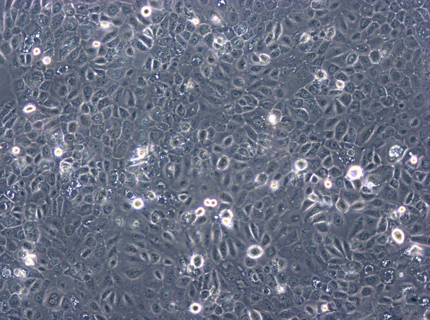SNU-251：人卵巢内膜癌传代细胞