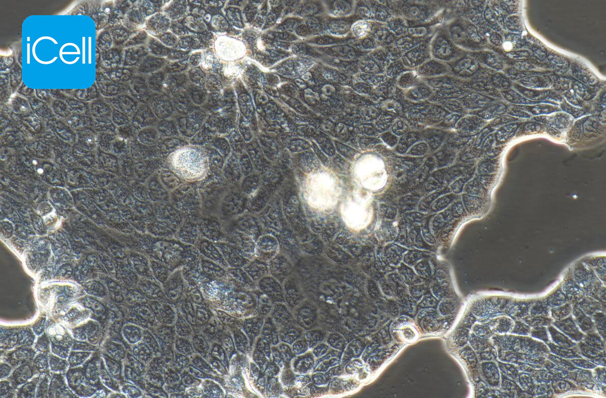 Calu-3 人肺腺癌细胞
