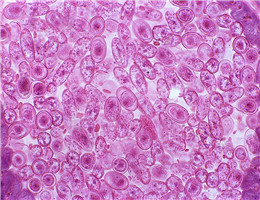 HEp-2人喉表皮癌细胞图片