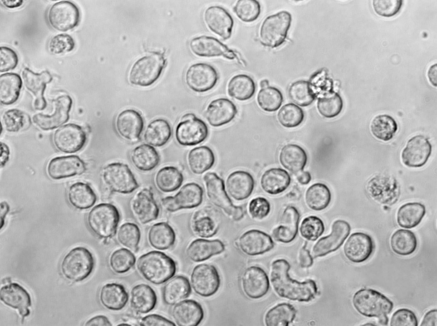 CA46 Cell|人burkitt淋巴瘤细胞