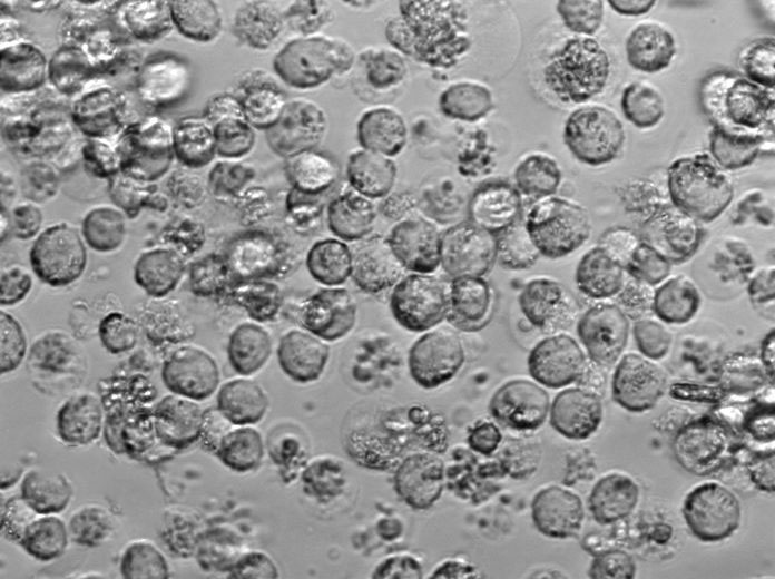 SUP-T1 Cell|人淋巴母细胞淋巴瘤细胞