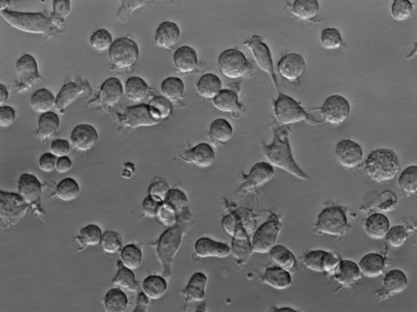 ST486 Cell|人B淋巴细胞瘤细胞