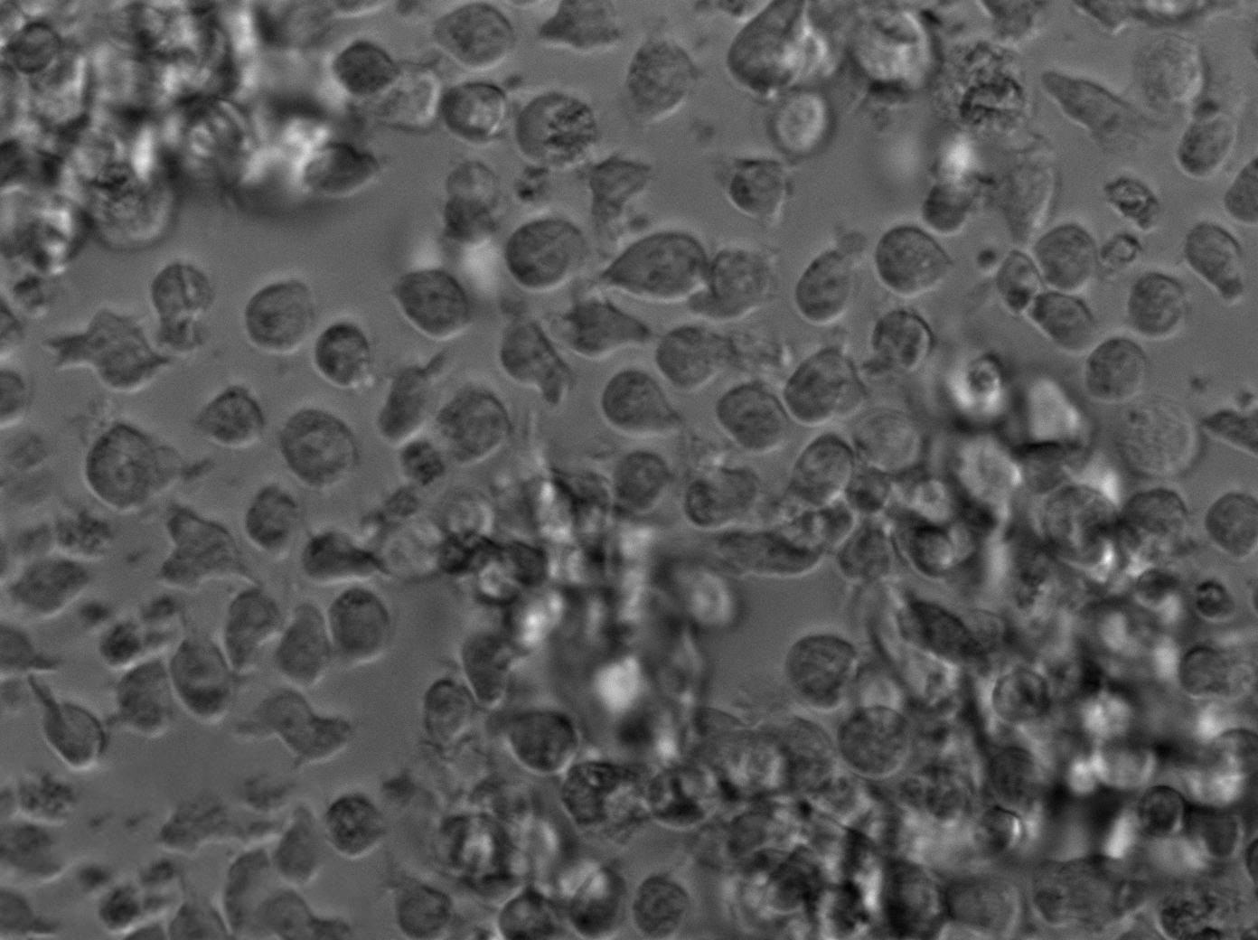 Namalwa Cell|人Burkitt＇s淋巴瘤细胞